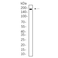 U-Blot® HER2 (Phospho Tyr1221/1222) Rabbit Monoclonal Antibody – Figure 1 of 1