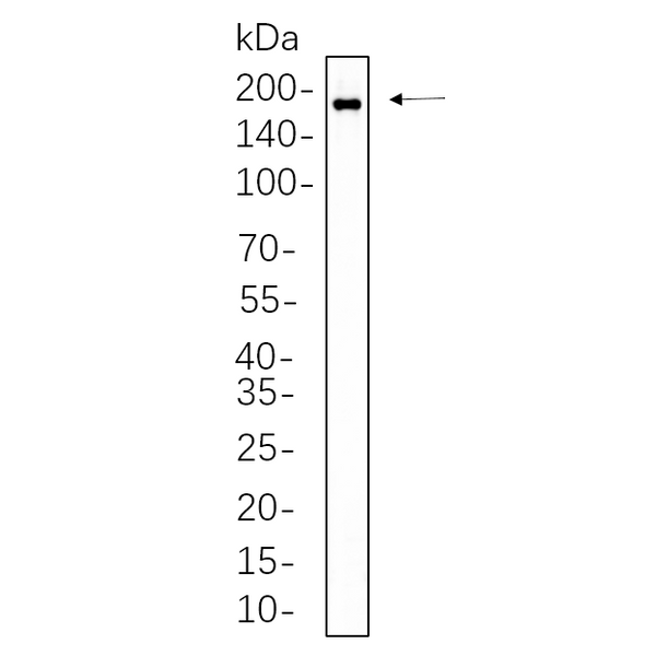 U-Blot® HER2 (Phospho Tyr1221/1222) Rabbit Monoclonal Antibody – Figure 1 of 1