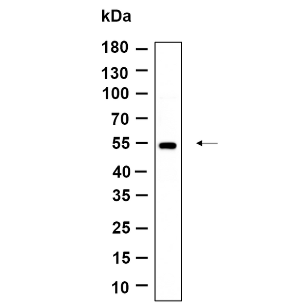 U-Blot® Tubulin α (Acetyl Lys40) Rabbit Monoclonal Antibody – Figure 1 of 1