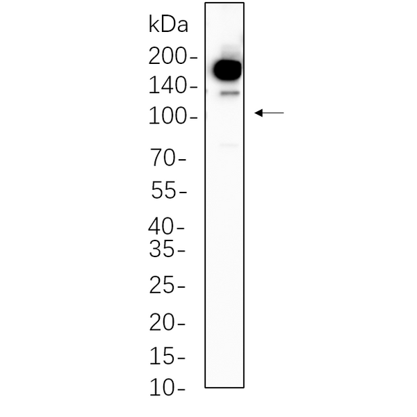 U-Blot® Met (Phospho Tyr1234/1235) Rabbit Monoclonal Antibody – Figure 1 of 1