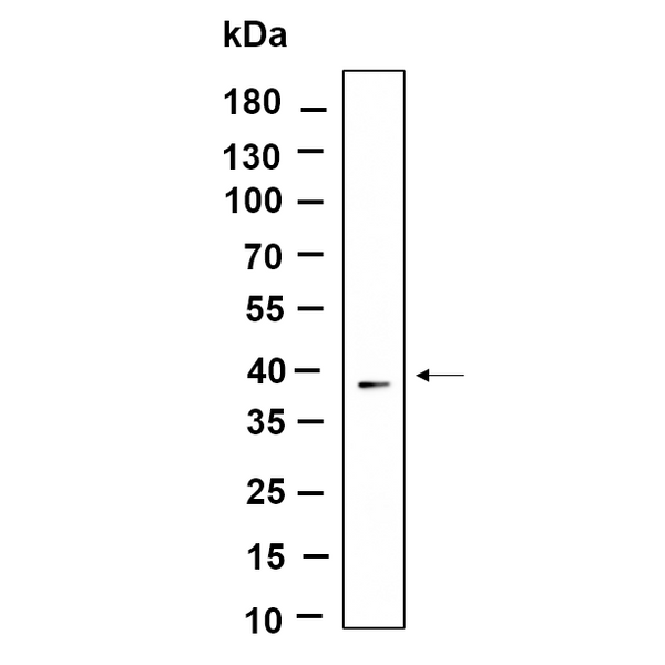 U-Blot® Nucleophosmin Rabbit Monoclonal Antibody – Figure 1 of 1