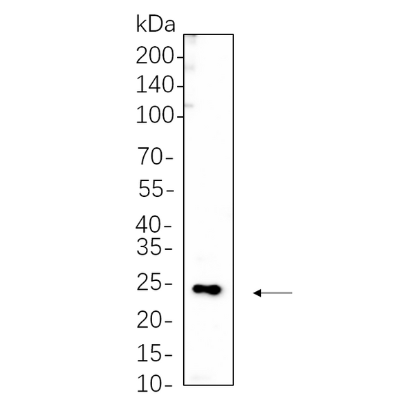 U-Blot® MYL9 (Phospho Thr18/Ser19) Rabbit Monoclonal Antibody – Figure 1 of 1