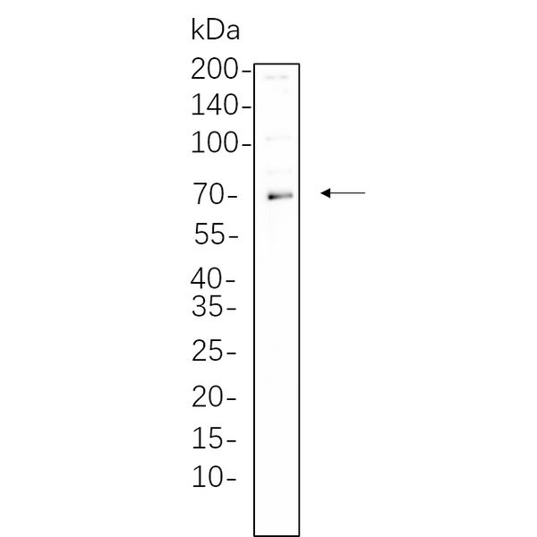 U-Blot® SYK (Phospho Tyr525/526) Rabbit Monoclonal Antibody – Figure 1 of 1