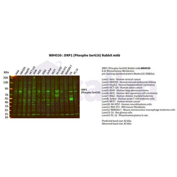 U-Blot® DRP1 (Phospho Ser616) Rabbit Monoclonal Antibody – Figure 1 of 2