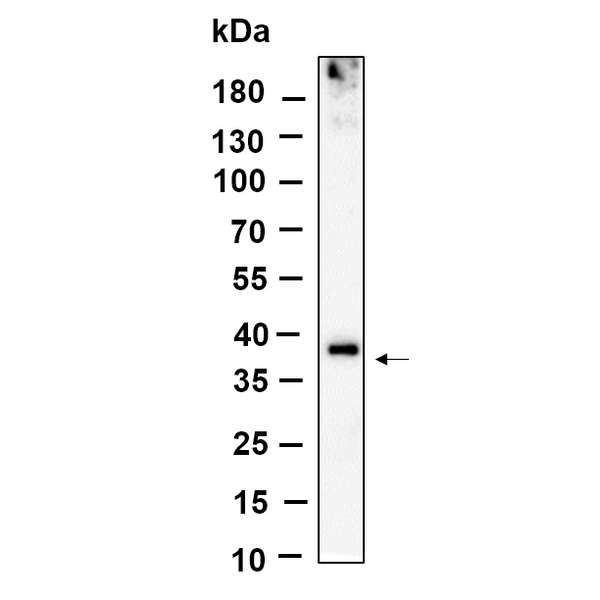 U-Blot® BNI3L Rabbit Monoclonal Antibody – Figure 1 of 1
