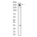 U-Blot® Collagen II Rabbit Monoclonal Antibody – Figure 1 of 1