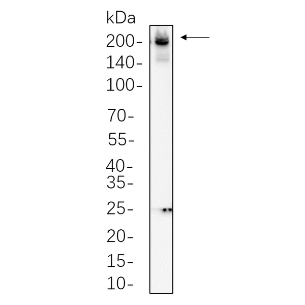 U-Blot® Collagen II Rabbit Monoclonal Antibody – Figure 1 of 1