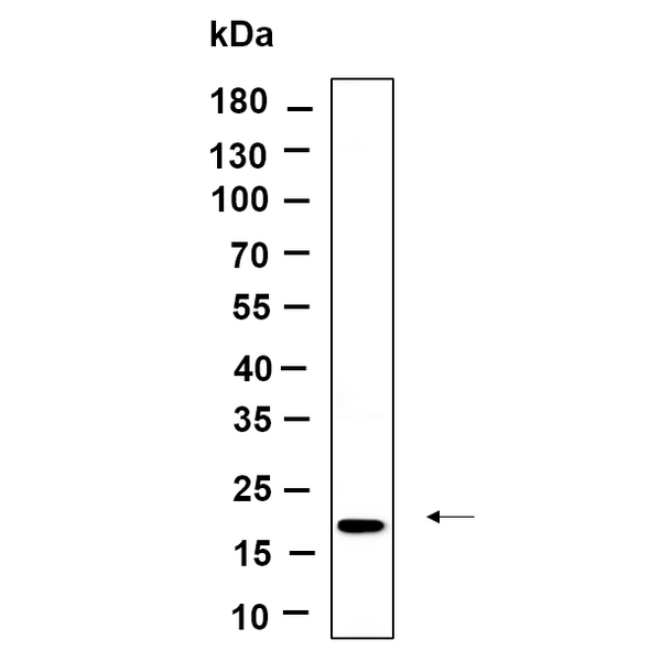 U-Blot® Osteocalcin Rabbit Monoclonal Antibody – Figure 1 of 1