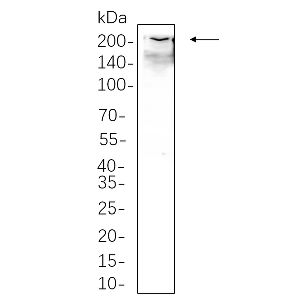 U-Blot® Collagen I Rabbit Monoclonal Antibody – Figure 1 of 1