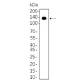 U-Blot® CD117/c-Kit Rabbit Monoclonal Antibody – Figure 1 of 1