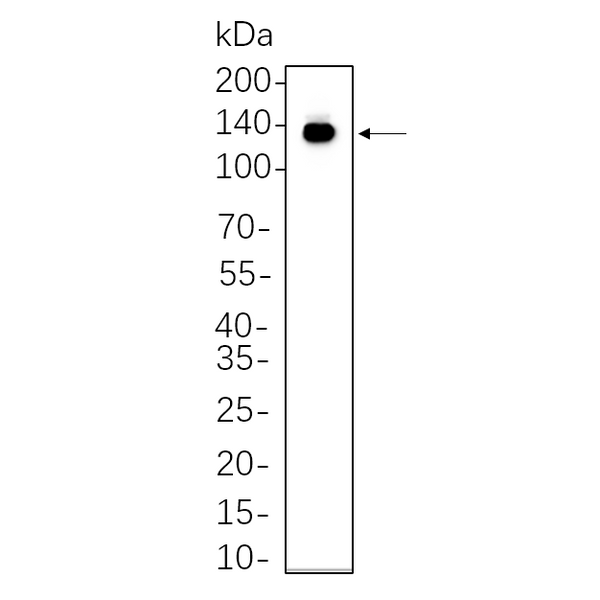 U-Blot® CD117/c-Kit Rabbit Monoclonal Antibody – Figure 1 of 1