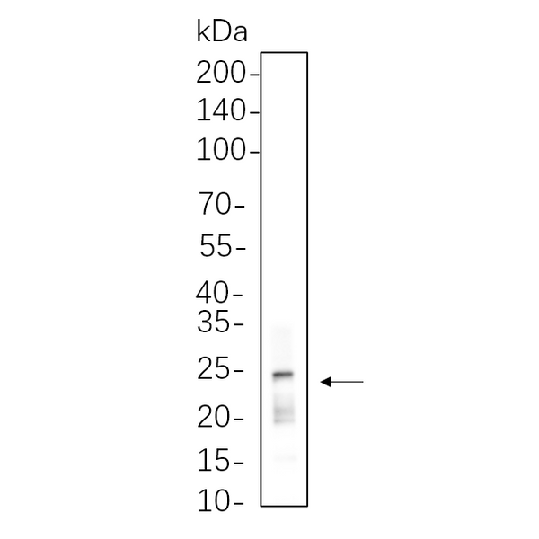 U-Blot® Rab11 Rabbit Monoclonal Antibody – Figure 1 of 1