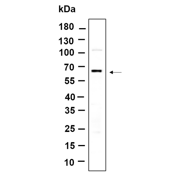 U-Blot® PINK1 Rabbit Monoclonal Antibody – Figure 1 of 1