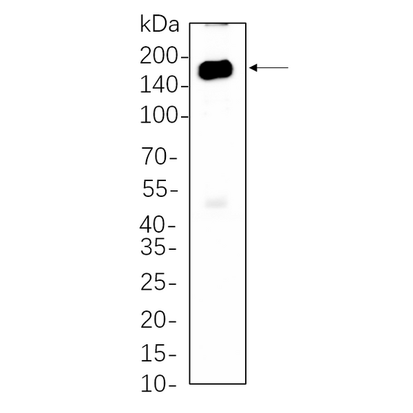 U-Blot® HDAC6 Rabbit Monoclonal Antibody – Figure 1 of 1
