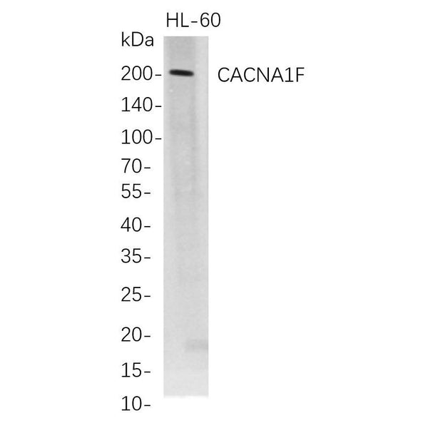 U-Blot® CACNA1F Rabbit Monoclonal Antibody – Figure 1 of 1