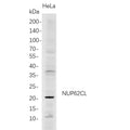 U-Blot® NUP62CL Rabbit Monoclonal Antibody – Figure 1 of 1