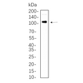 U-Blot® Androgen Receptor Rabbit Monoclonal Antibody – Figure 1 of 1