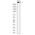 U-Blot® ATM Rabbit Monoclonal Antibody – Figure 1 of 1