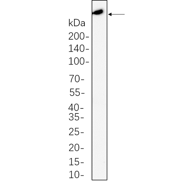 U-Blot® ATM Rabbit Monoclonal Antibody – Figure 1 of 1