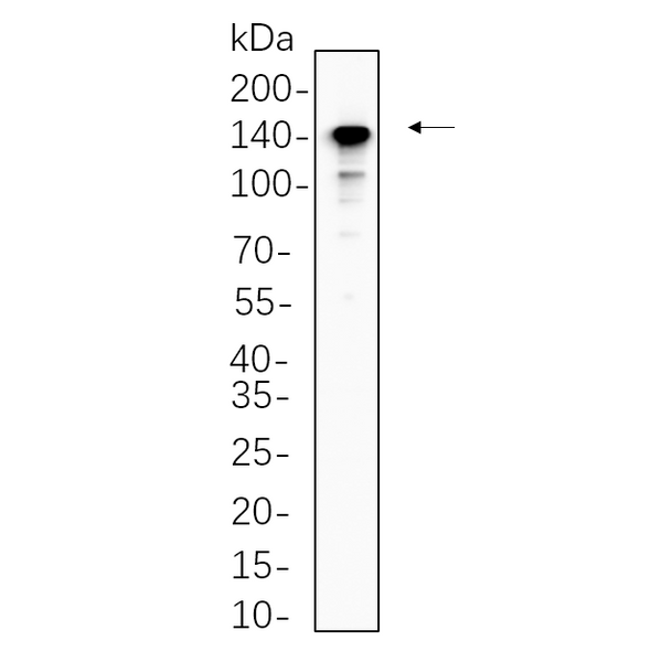 U-Blot® CD163 Rabbit Monoclonal Antibody – Figure 1 of 1