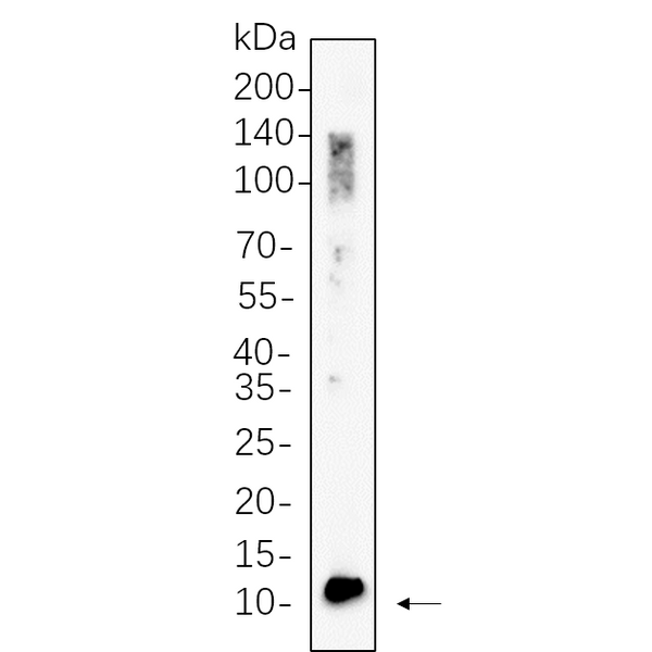U-Blot® BDNF Rabbit Monoclonal Antibody – Figure 1 of 1