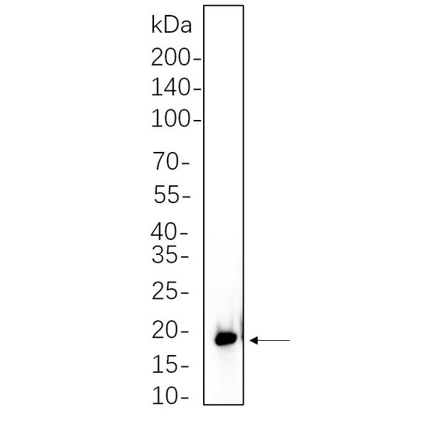 U-Blot® 4E-BP1 (Phospho 4E-BP1 (Phospho Thr37/46)) Rabbit Monoclonal Antibody – Figure 1 of 1