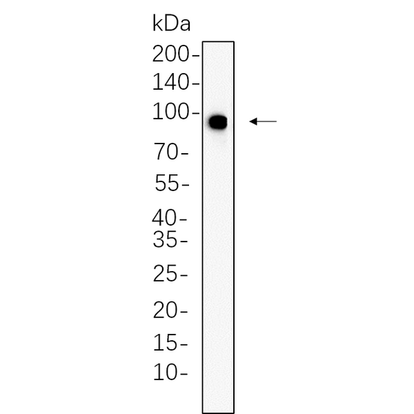 U-Blot® IGF1R (Phospho Tyr1135/1136)/Insulin Receptor β (Phospho Tyr1150/1151) Rabbit Monoclonal Antibody – Figure 1 of 1