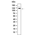 U-Blot® PERK (Phospho Thr980) Rabbit Monoclonal Antibody – Figure 1 of 1