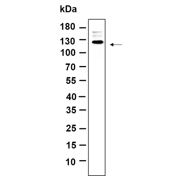 U-Blot® PERK (Phospho Thr980) Rabbit Monoclonal Antibody – Figure 1 of 1