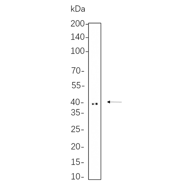 U-Blot® Doublecortin Rabbit Monoclonal Antibody – Figure 1 of 1