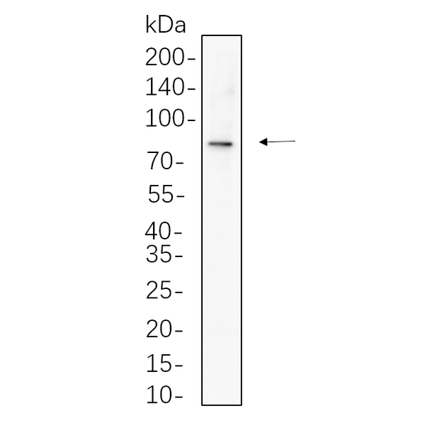 U-Blot® RRM1 Rabbit Monoclonal Antibody – Figure 1 of 1