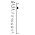 U-Blot® PI3-Kinase p110α Rabbit Monoclonal Antibody – Figure 1 of 1