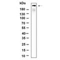 U-Blot® BRCA1 Rabbit Monoclonal Antibody – Figure 1 of 1