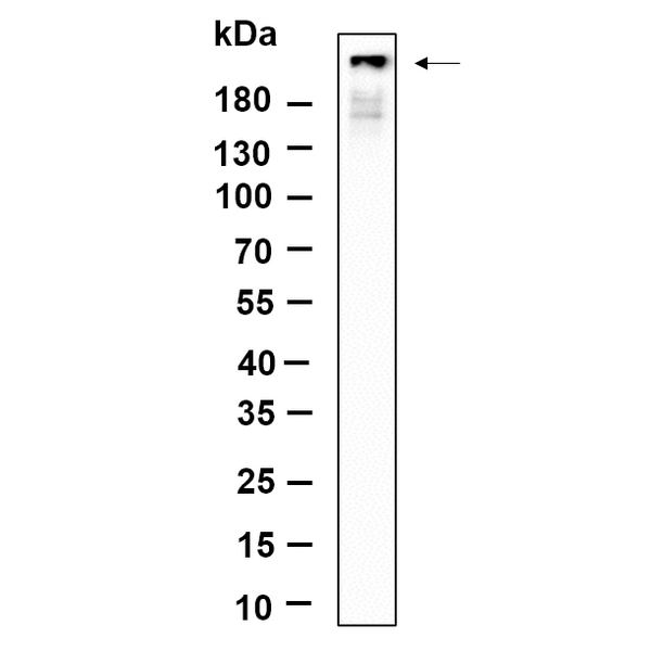 U-Blot® BRCA1 Rabbit Monoclonal Antibody – Figure 1 of 1