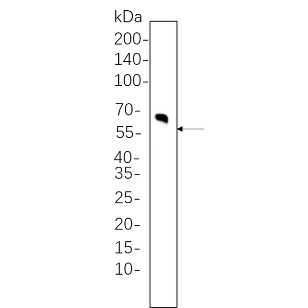 U-Blot® Tyrosine Hydroxylase Rabbit Monoclonal Antibody – Figure 1 of 1