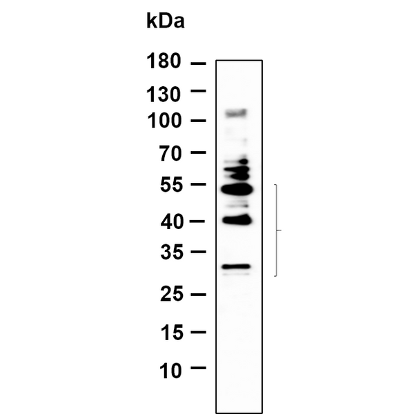 U-Blot® BNIP-3 Rabbit Monoclonal Antibody – Figure 1 of 1