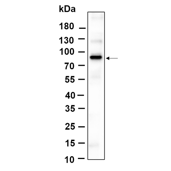 U-Blot® β Catenin (Phospho Ser37) Rabbit Monoclonal Antibody – Figure 1 of 1