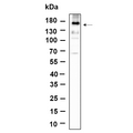 U-Blot® EGFR (Phospho Tyr1068) Rabbit Monoclonal Antibody – Figure 1 of 1