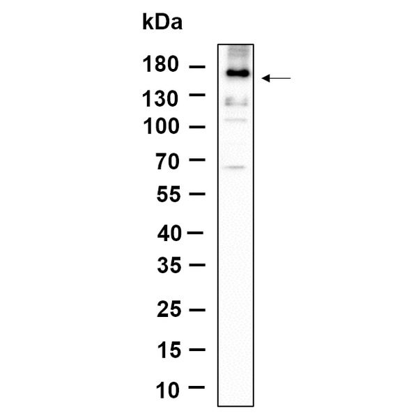 U-Blot® EGFR (Phospho Tyr1068) Rabbit Monoclonal Antibody – Figure 1 of 1