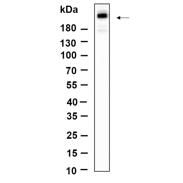 U-Blot® mTOR (Phospho Ser2481) Rabbit Monoclonal Antibody – Figure 1 of 1