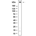 U-Blot® ATM (Phospho Ser1981) Rabbit Monoclonal Antibody – Figure 1 of 1
