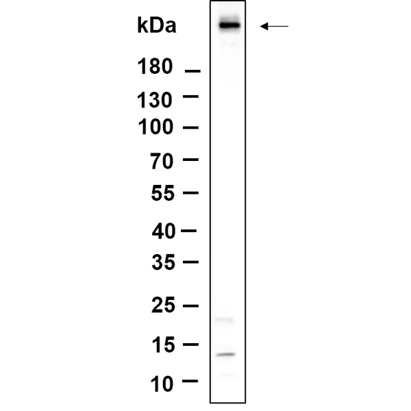 U-Blot® ATM (Phospho Ser1981) Rabbit Monoclonal Antibody – Figure 1 of 1