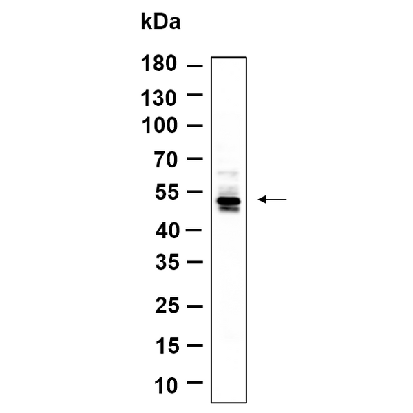 U-Blot® CaMKII α/β (Phospho Thr286) Rabbit Monoclonal Antibody – Figure 1 of 1