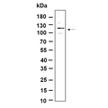 U-Blot® FAK (Phospho Tyr397) Rabbit Monoclonal Antibody – Figure 1 of 1