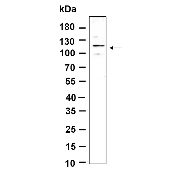 U-Blot® FAK (Phospho Tyr397) Rabbit Monoclonal Antibody – Figure 1 of 1