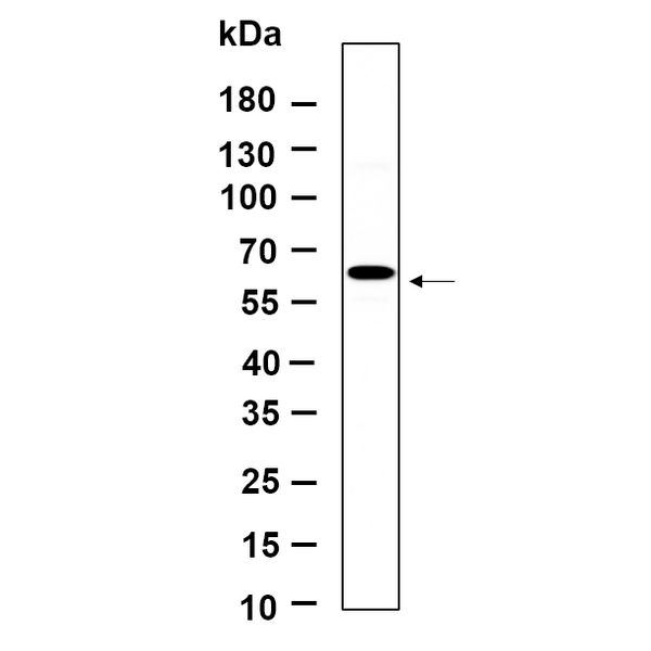 U-Blot® p70 S6 kinase β (Phospho Ser371) Rabbit Monoclonal Antibody – Figure 1 of 1