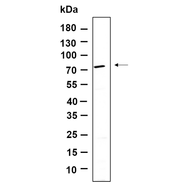 U-Blot® BIRC2 Rabbit Monoclonal Antibody – Figure 1 of 1