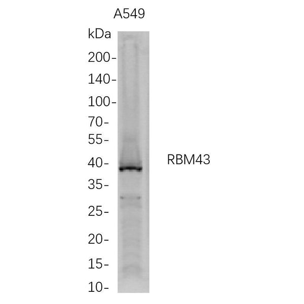 U-Blot® RBM43 Rabbit Monoclonal Antibody – Figure 1 of 1