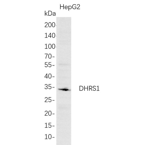 U-Blot® DHRS1 Rabbit Monoclonal Antibody – Figure 1 of 1