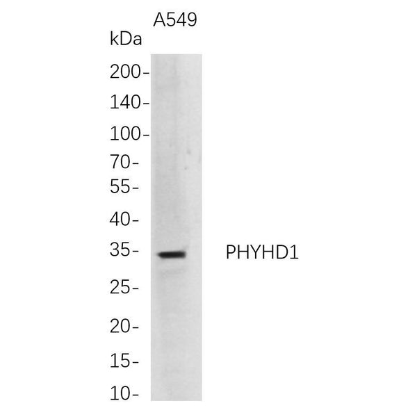 U-Blot® PHYHD1 Rabbit Monoclonal Antibody – Figure 1 of 1